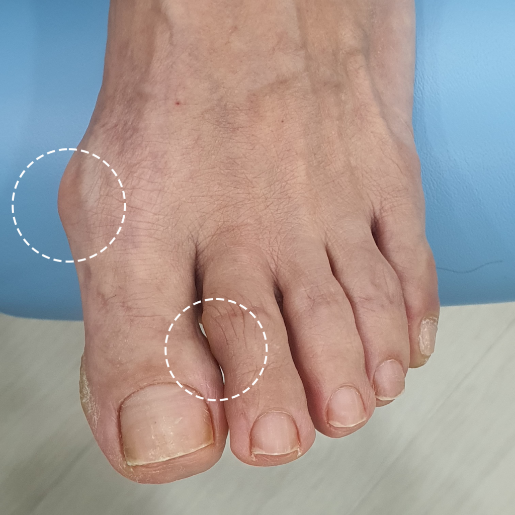 오른쪽-발-촬영