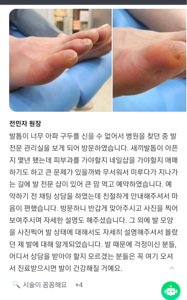 이 이미지의 모든 내용을 상세히 기재하겠습니다.

1. **상단 이미지**: 
   - 왼쪽 사진: 치료 전 발가락, 특히 엄지발가락 옆에 굳은살이 두꺼워진 모습이 보입니다.
   - 오른쪽 사진: 굳은살이 제거된 후 발가락의 매끄럽고 정돈된 상태를 보여줍니다.

2. **텍스트 내용**:
   - 제목: **전민자 원장**
   - 본문: 발톱이 너무 아파 구두를 신을 수 없어서 병원을 찾던 중 발 전문 관리실을 보게 되어 방문하였습니다. 새끼발톱이 아프지 몇 년 됐는데 피부과를 가야할지 네일샵을 가야할지 애매하기도 하고 큰 문제가 있을까봐 무서워서 미루다가 지나가는 길에 발 전문 샵이 있어 큰 맘 먹고 예약하였습니다. 예약하기 전 채팅 상담을 하였는데 친절하게 안내해주셔서 마음이 편했습니다. 방문하니 반갑게 맞아주시고 사진을 찍어 보여주시며 자세한 설명도 해주셨습니다. 그 외에 발 모양을 사진찍어 발 상태에 대해서도 자세히 설명해주셔서 몰랐던 제 발에 대해 알게되었습니다. 발 때문에 걱정이신 분들, 어디서 상담을 받아야 할지 모르겠는 분들은 꼭 여기 오셔서 진료받으시면 발이 건강해질 거예요.
3. **댓글/반응**:
   - **시술이 꼼꼼해요** +4

이 이미지의 모든 내용은 발 관리 후기를 공유하는 게시물로, 환자가 깊은 굳은살 관리와 발 건강에 대한 상담을 받은 경험을 자세히 설명한 글이 포함되어 있습니다.