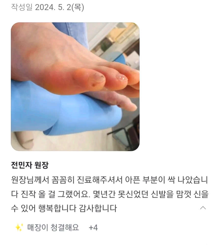 이 이미지의 내용은 발 치료 후기를 담고 있으며, 작성일은 **2024년 5월 2일(목)**로 기재되어 있습니다.

1. **이미지**: 발가락을 클로즈업한 사진으로, 발의 아픈 부분이 치료된 후 상태를 보여줍니다. 발가락의 피부가 매끄럽고 정돈된 모습이며, 전문적인 발 관리가 이루어진 후의 상태를 강조하고 있습니다.

2. **텍스트 내용**:
   - 제목: **전민자 원장**
   - 본문: 원장님께서 꼼꼼히 진료해주셔서 아픈 부분이 싹 나았습니다 진작 올 걸 그랬어요. 몇 년간 못 신었던 신발을 맘껏 신을 수 있어 행복합니다 감사합니다
3. **댓글/반응**:
   - **✨ 매장이 청결해요** +4
이 이미지와 글은 발 관리 후기를 통해 원장의 꼼꼼한 진료와 치료 효과를 강조하고 있으며, 환자가 오랜 기간 겪었던 발 문제를 해결한 후 신발을 편히 신을 수 있게 된 경험을 담고 있습니다.