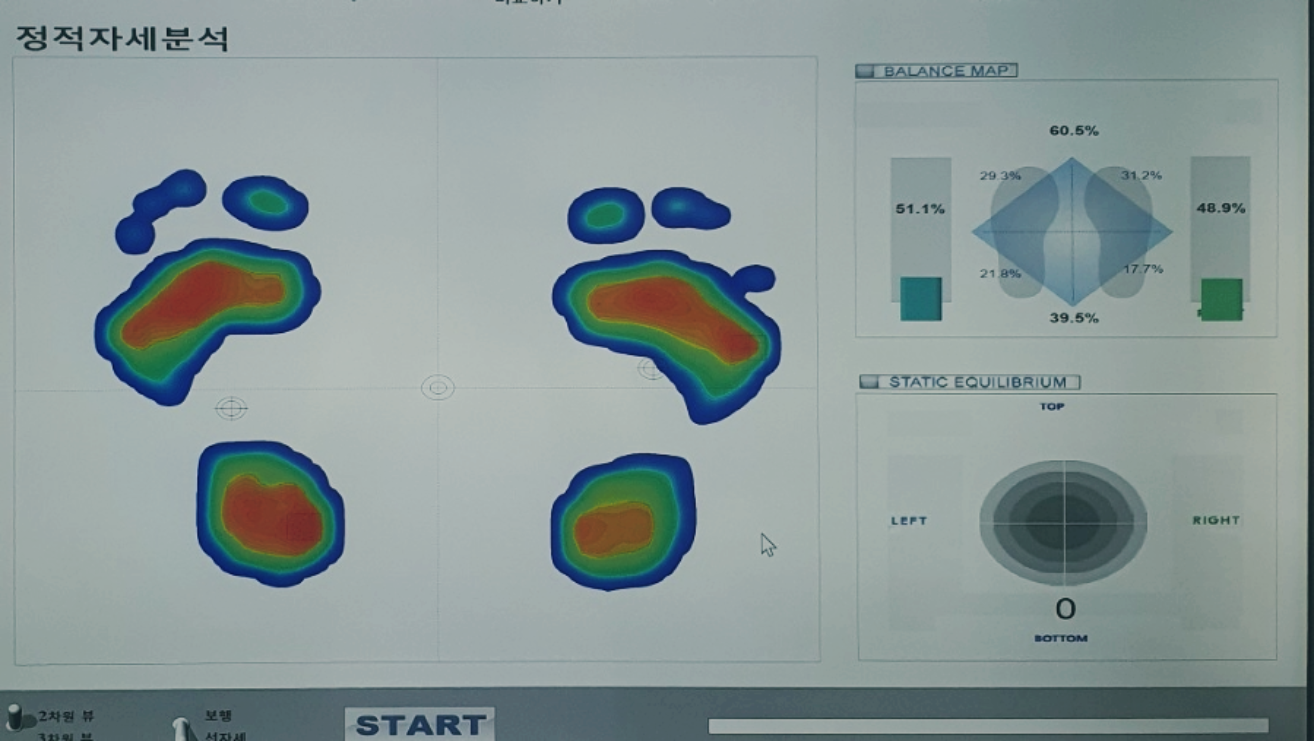발바닥 압력 분포를 시각화한 정적 자세 분석 이미지로, 좌우 균형과 정적 상태의 균형이 그래프로 표시되어 있습니다.