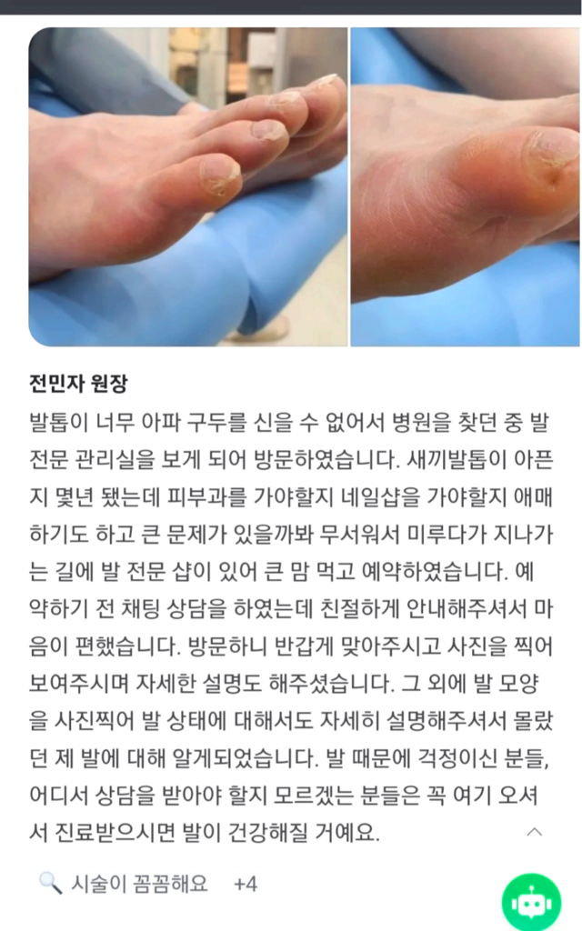 이 이미지의 모든 내용을 상세히 기재하겠습니다.
1. **상단 이미지**:
- 왼쪽 사진: 치료 전 발가락, 특히 엄지발가락 옆에 굳은살이 두꺼워진 모습이 보입니다.
- 오른쪽 사진: 굳은살이 제거된 후 발가락의 매끄럽고 정돈된 상태를 보여줍니다.
2. **텍스트 내용**:
- 제목: **전민자 원장**
- 본문: 발톱이 너무 아파 구두를 신을 수 없어서 병원을 찾던 중 발 전문 관리실을 보게 되어 방문하였습니다. 새끼발톱이 아프지 몇 년 됐는데 피부과를 가야할지 네일샵을 가야할지 애매하기도 하고 큰 문제가 있을까봐 무서워서 미루다가 지나가는 길에 발 전문 샵이 있어 큰 맘 먹고 예약하였습니다. 예약하기 전 채팅 상담을 하였는데 친절하게 안내해주셔서 마음이 편했습니다. 방문하니 반갑게 맞아주시고 사진을 찍어 보여주시며 자세한 설명도 해주셨습니다. 그 외에 발 모양을 사진찍어 발 상태에 대해서도 자세히 설명해주셔서 몰랐던 제 발에 대해 알게되었습니다. 발 때문에 걱정이신 분들, 어디서 상담을 받아야 할지 모르겠는 분들은 꼭 여기 오셔서 진료받으시면 발이 건강해질 거예요.
3. **댓글/반응**:
- **시술이 꼼꼼해요** +4
이 이미지의 모든 내용은 발 관리 후기를 공유하는 게시물로, 환자가 깊은 굳은살 관리와 발 건강에 대한 상담을 받은 경험을 자세히 설명한 글이 포함되어 있습니다.