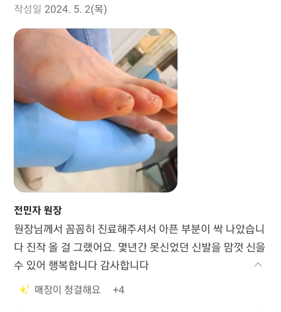 이 이미지의 내용은 발 치료 후기를 담고 있으며, 작성일은 **2024년 5월 2일(목)**로 기재되어 있습니다.
1. **이미지**: 발가락을 클로즈업한 사진으로, 발의 아픈 부분이 치료된 후 상태를 보여줍니다. 발가락의 피부가 매끄럽고 정돈된 모습이며, 전문적인 발 관리가 이루어진 후의 상태를 강조하고 있습니다.
2. **텍스트 내용**:
- 제목: **전민자 원장**
- 본문: 원장님께서 꼼꼼히 진료해주셔서 아픈 부분이 싹 나았습니다 진작 올 걸 그랬어요. 몇 년간 못 신었던 신발을 맘껏 신을 수 있어 행복합니다 감사합니다
3. **댓글/반응**:
- **✨ 매장이 청결해요** +4
이 이미지와 글은 발 관리 후기를 통해 원장의 꼼꼼한 진료와 치료 효과를 강조하고 있으며, 환자가 오랜 기간 겪었던 발 문제를 해결한 후 신발을 편히 신을 수 있게 된 경험을 담고 있습니다.